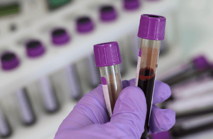 Blood samples in EDTA tubes